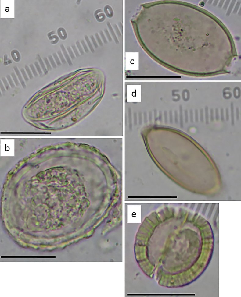 Toilet Parasites Date Back To 7Th-Century Jerusalem, Show Influence On Region'S Elite Limp