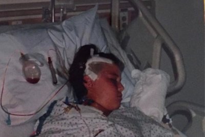 David Fitting After Surgery At 10-Years-Old David Fitting After Surgery At 10-Years-Old