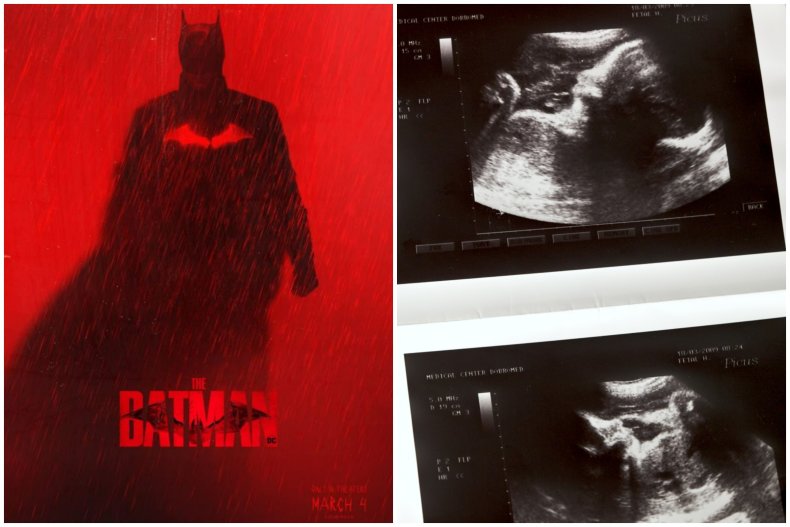 Batman movie poster and ultrasound scan
