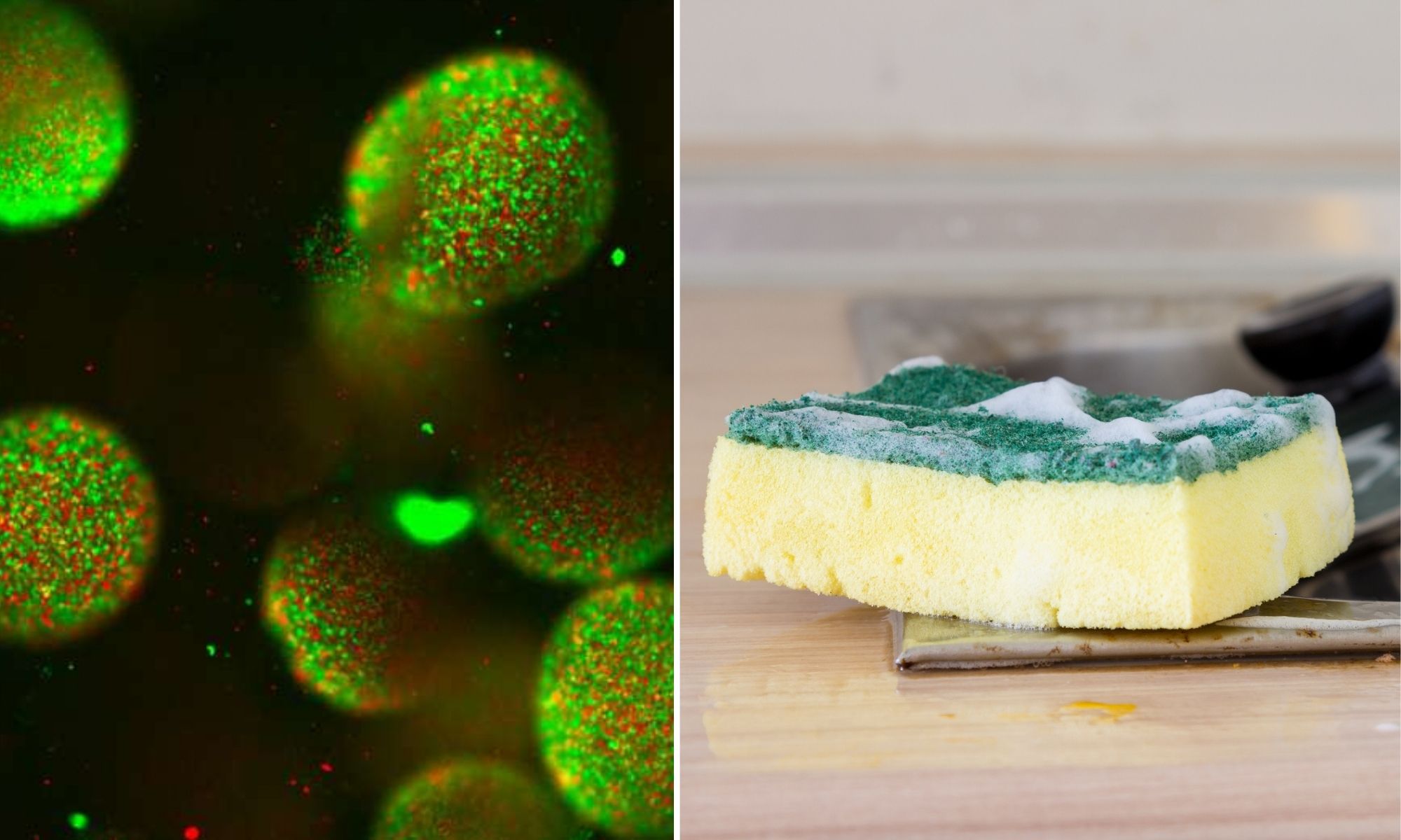 How Worried Should I Be About Bacteria on Kitchen Sponges?