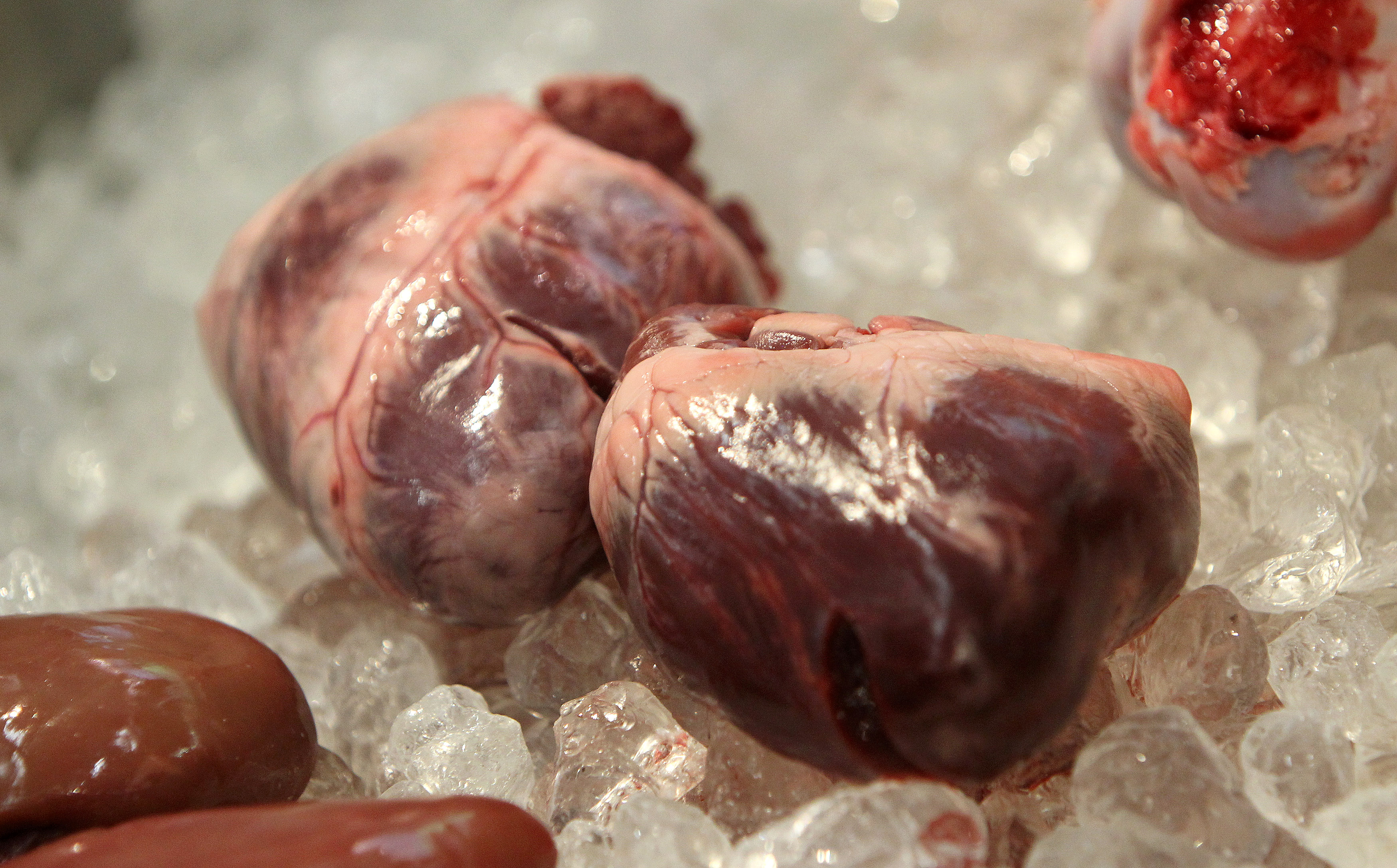 Doctors 'Devastated' by Death of Man Who Got First Pig Heart Transplant