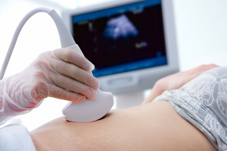 Baby scan