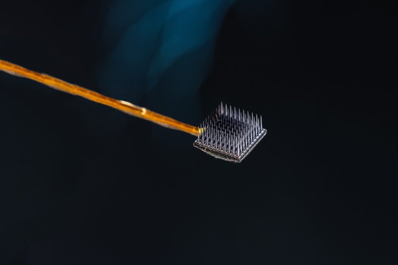 Brain Implant