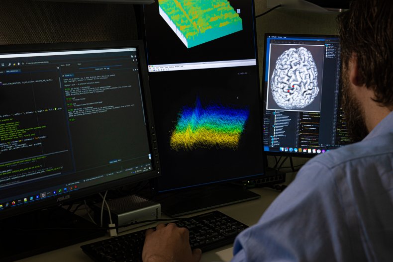 Brain Implant