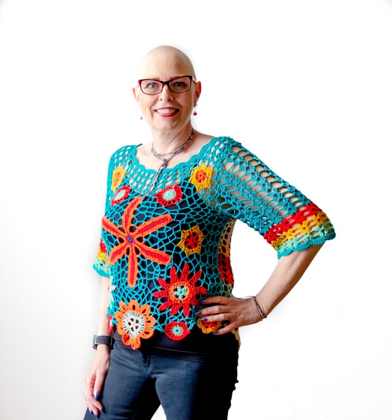 Lesley Walsh Has Had Alopecia Since 2014
