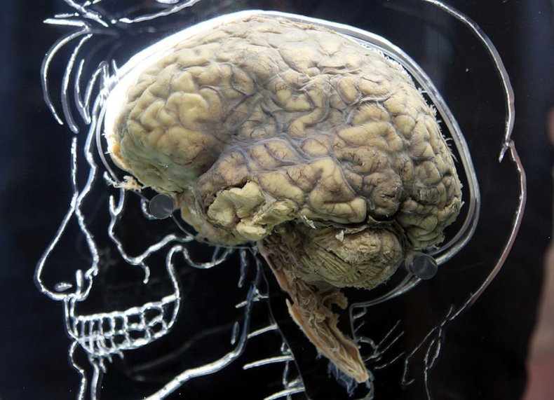 Human brain on display