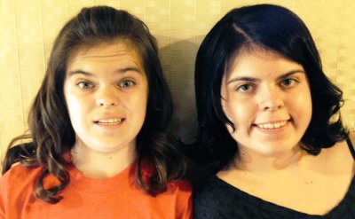 Twins Abigail and Amelia both have TSC Twins Abigail and Amelia both have TSC