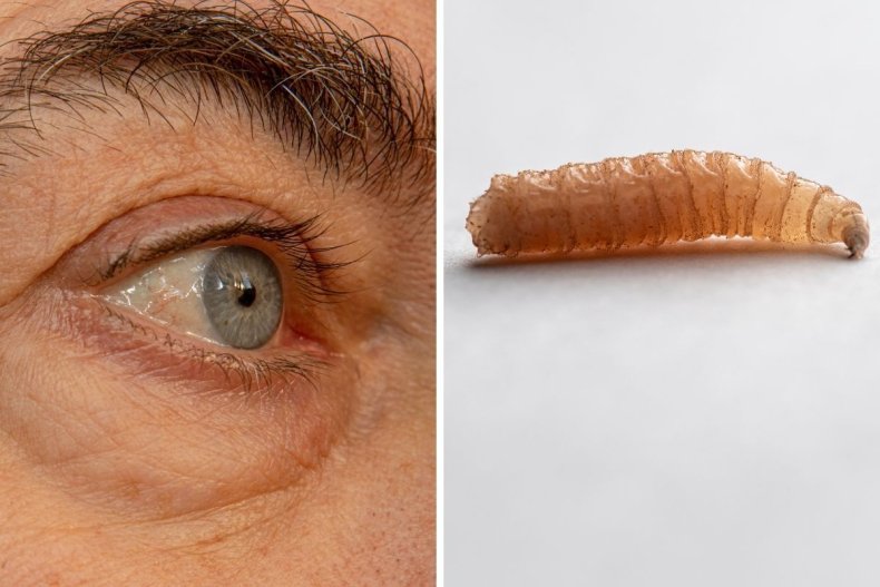 Split image of man's eye and maggot