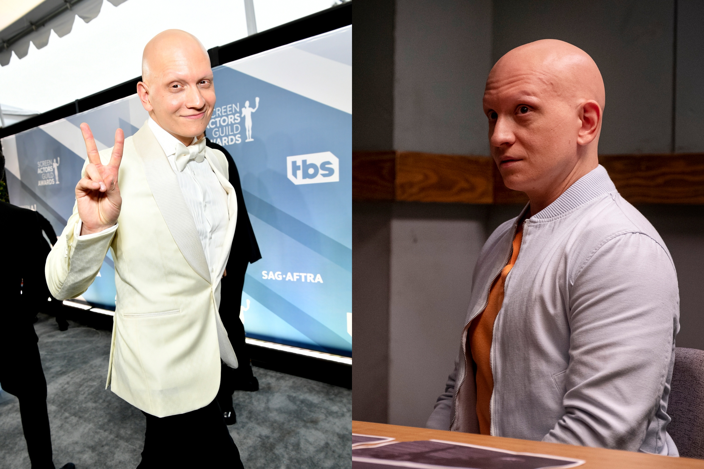 I Rock My Alopecia'—'Barry' Actor Anthony Carrigan Responds to Oscars Joke