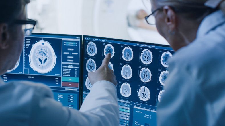 Brain scan