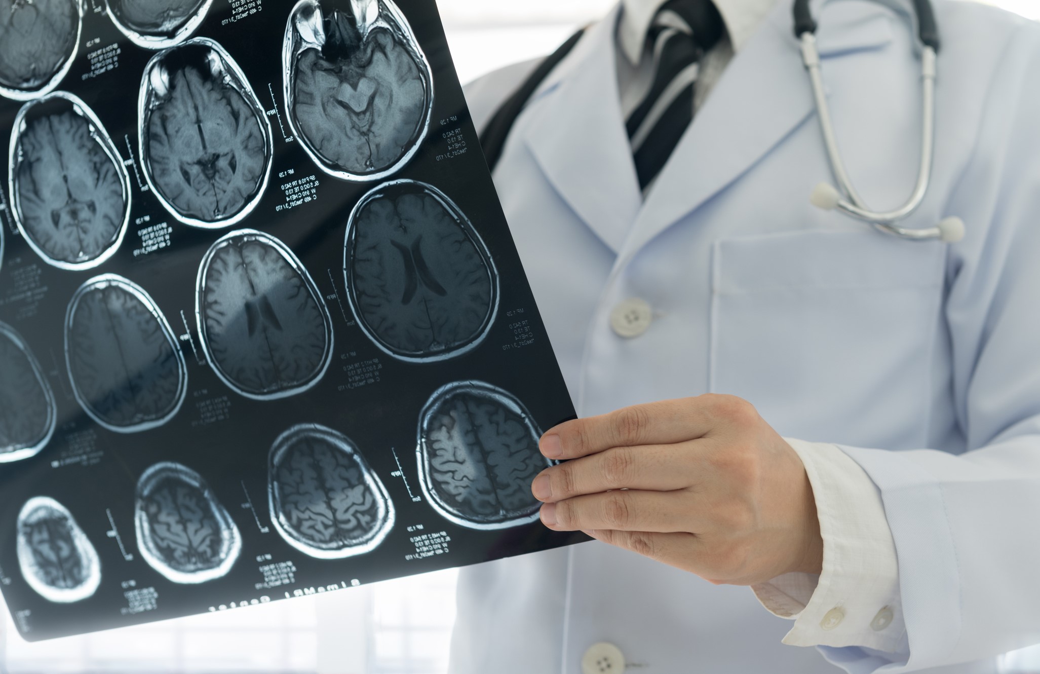 Radon Investigated as Cause of Over 100 Brain Tumors at New Jersey School