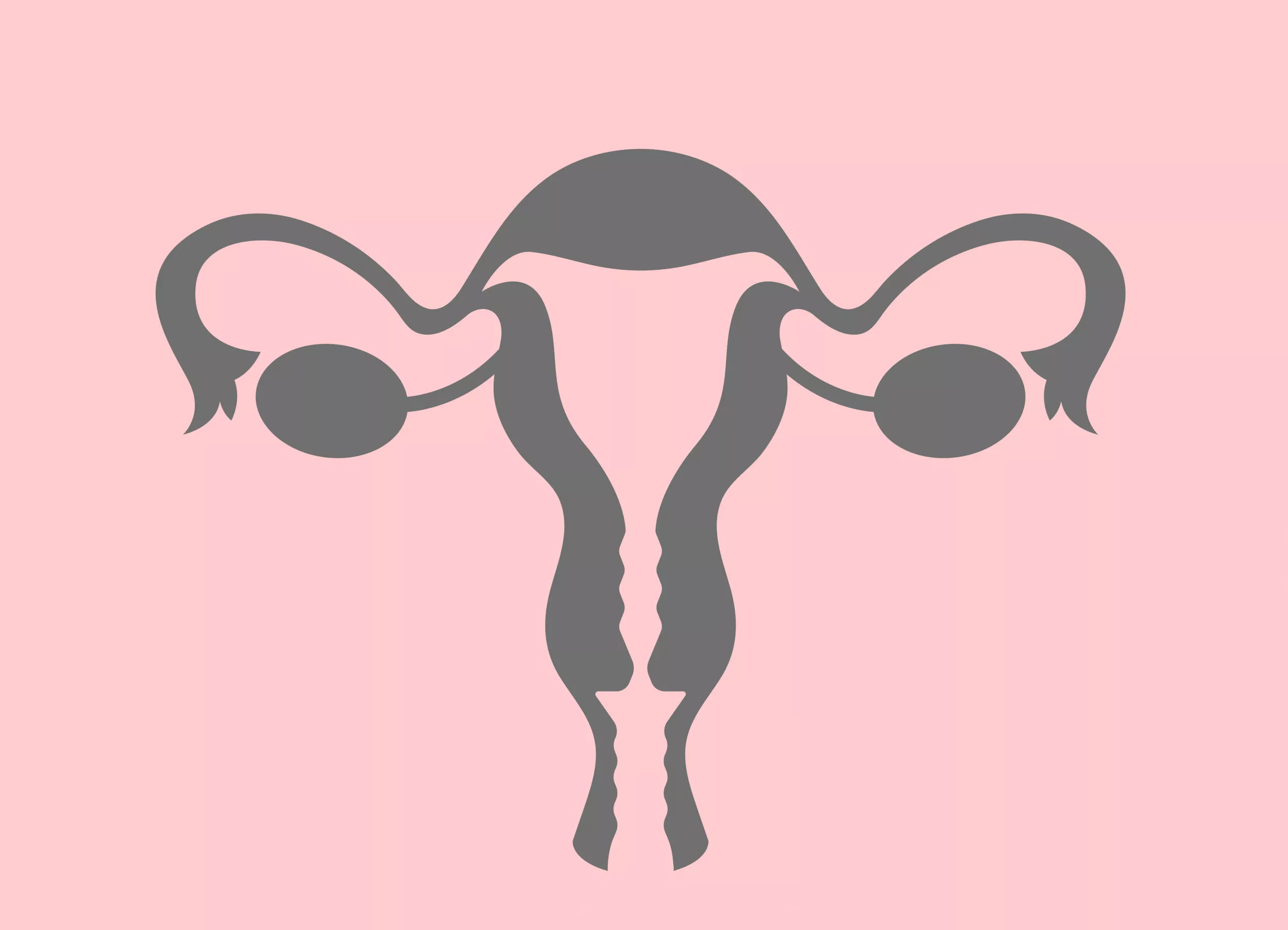 Tubal Ligation, Salpingectomy and Sterilization Searches Shoot Up in U.S. - Vimarsana News