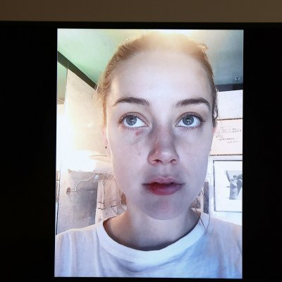 Heard Black Eye Heard Black Eye