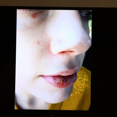 Heard Busted Lip Heard Busted Lip