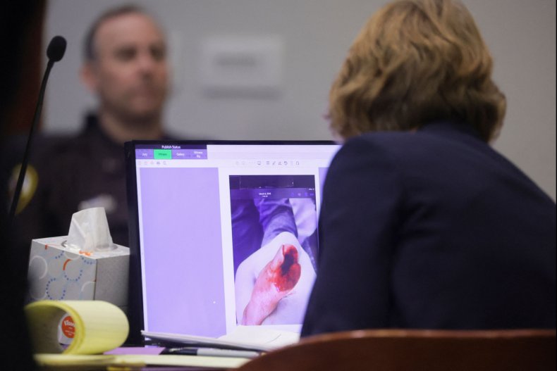 Johnny Depp's severed finger