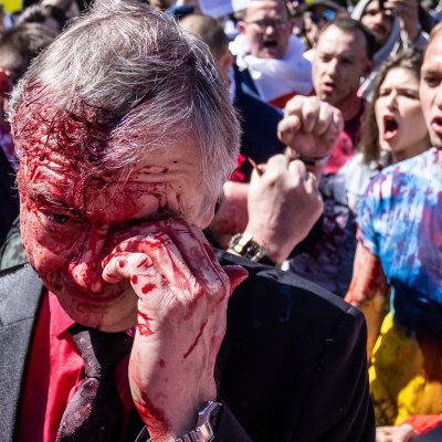 Andreev Gets Paint in His Eye Andreev Gets Paint in His Eye