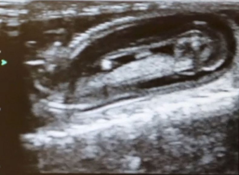 Snake fetus study