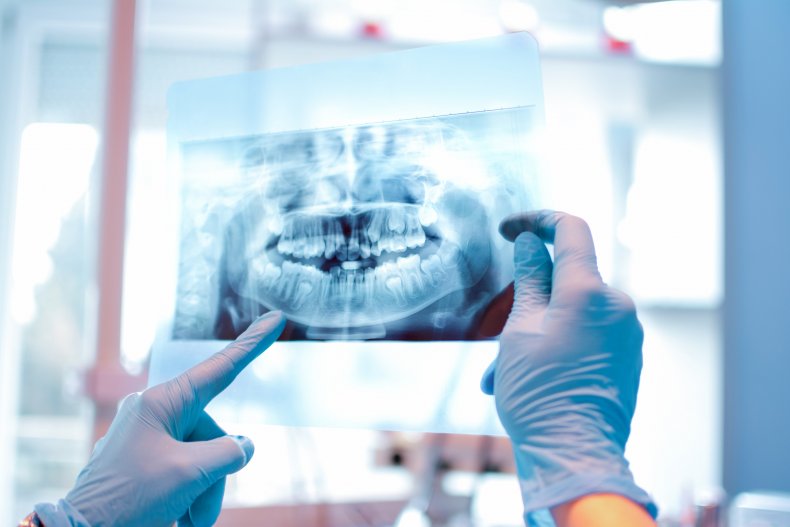Dentist holds up dental x-ray