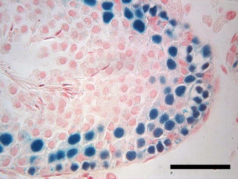 Cross-section of infertile mouse testis