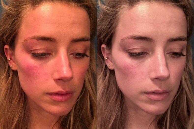 Amber Heard images allegedly edited