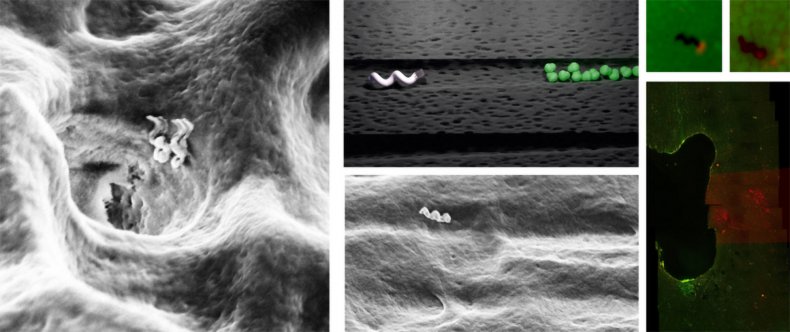 Nanobots can deep clean teeth