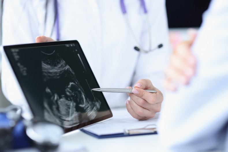 Doctor demonstrates fetal ultrasound