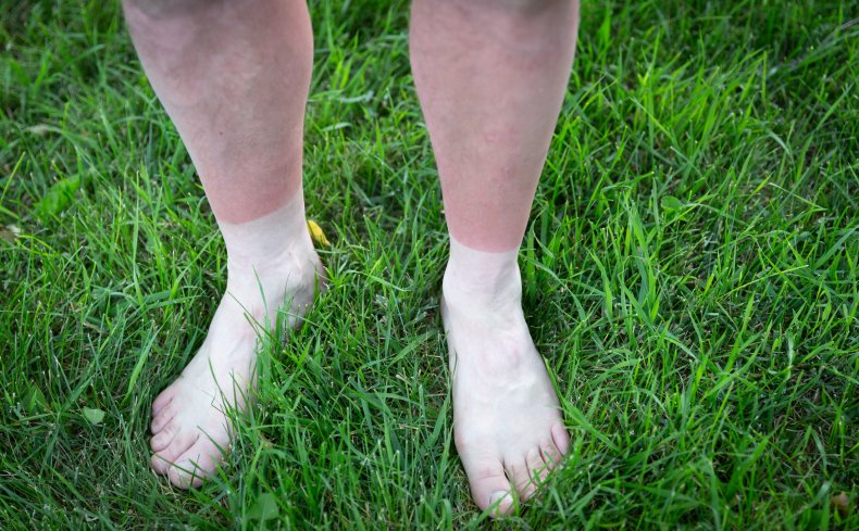 'Neapolitan Ice Cream' Tan Lines Horrify Internet
