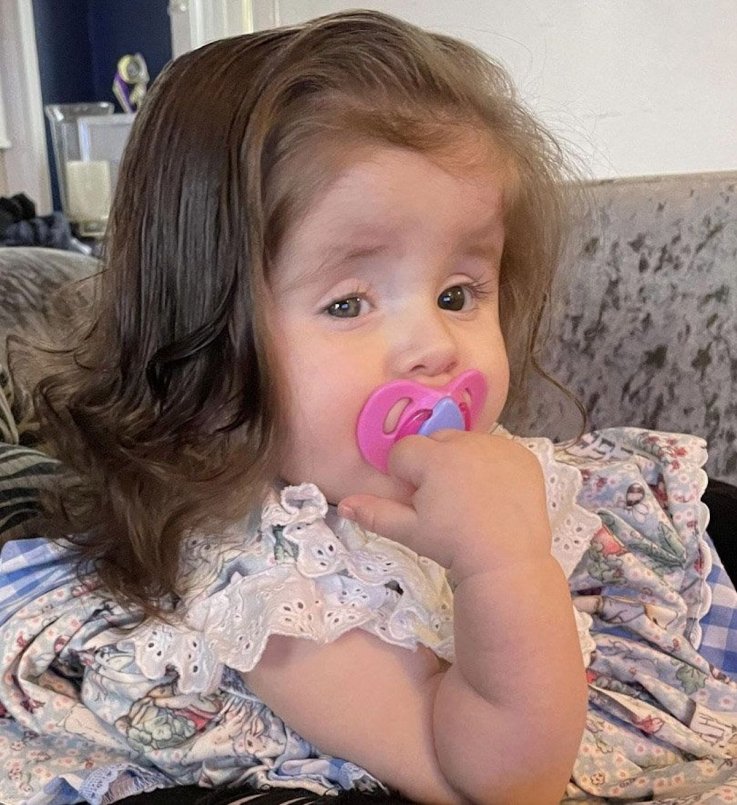 Sydney Miller has Primrose syndrome