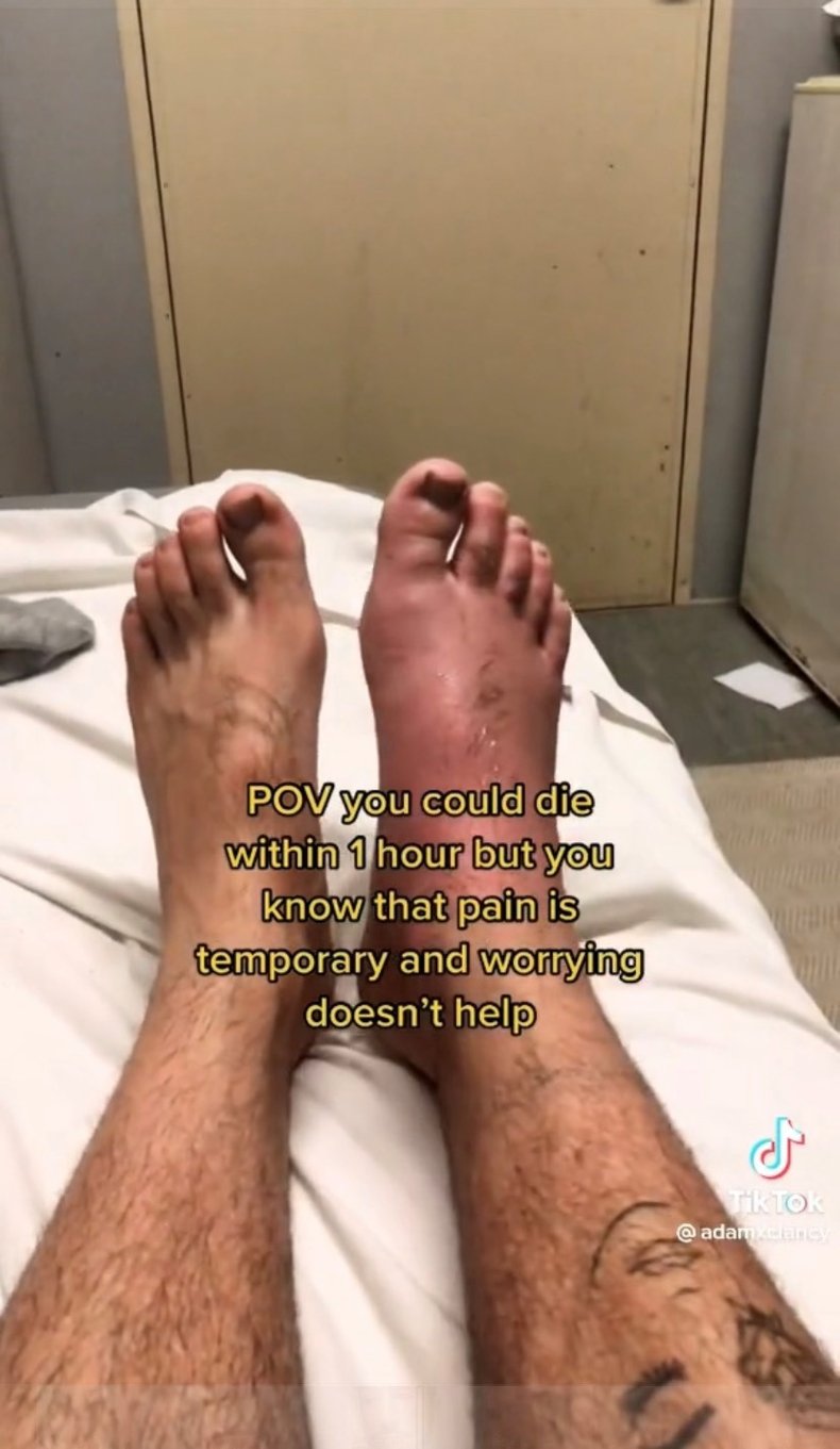 Adam Clancy's foot