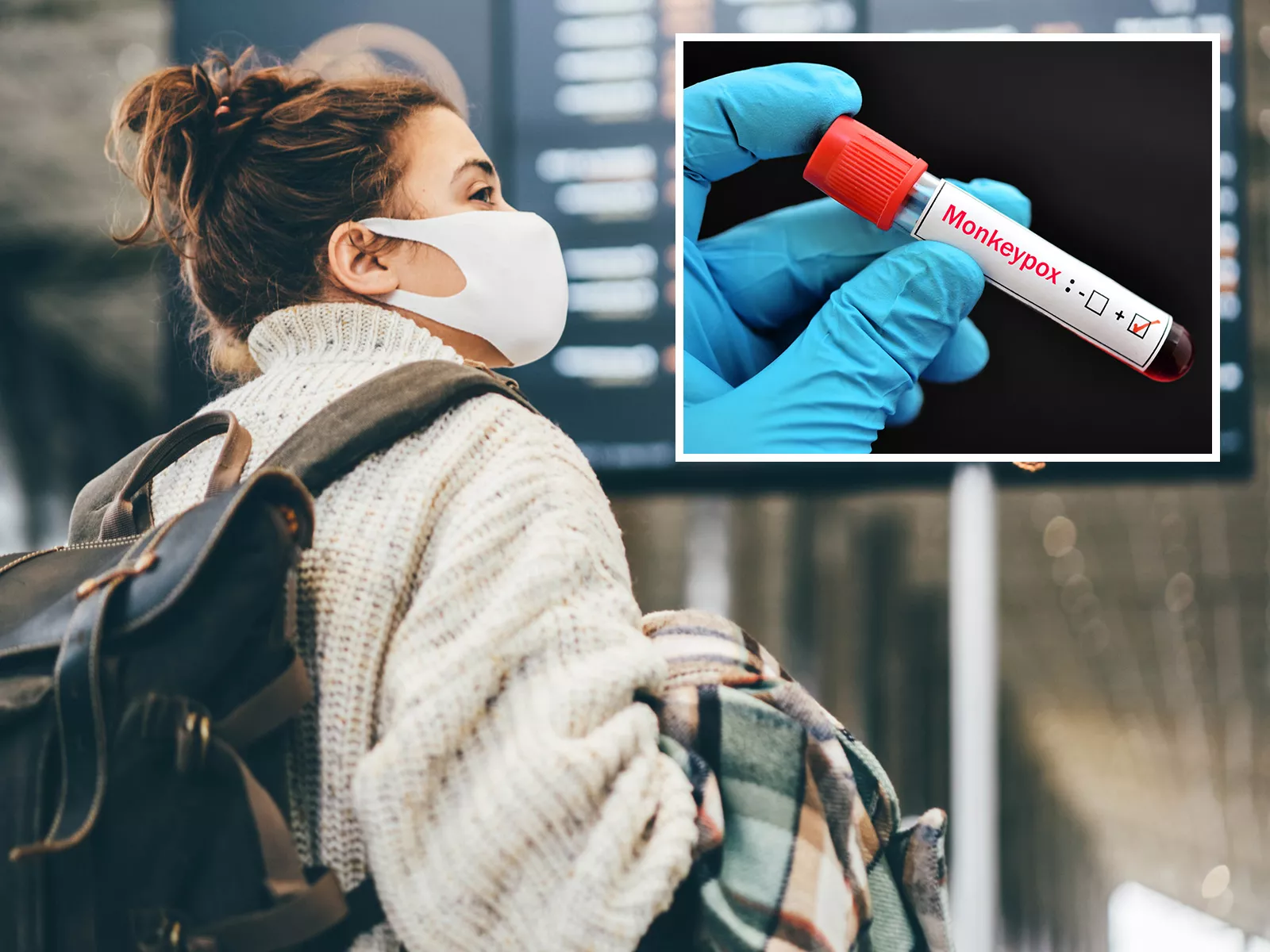CDC Sparks Backlash After Ditching Monkeypox Mask Advice - Vimarsana News