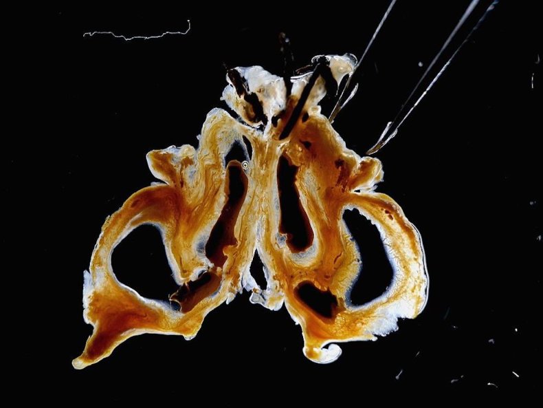 Chamber tissue through microscope