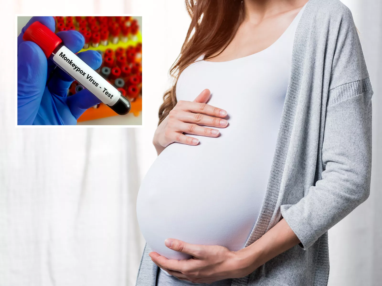 What Are The Risks Of Monkeypox In Pregnancy - Vimarsana News