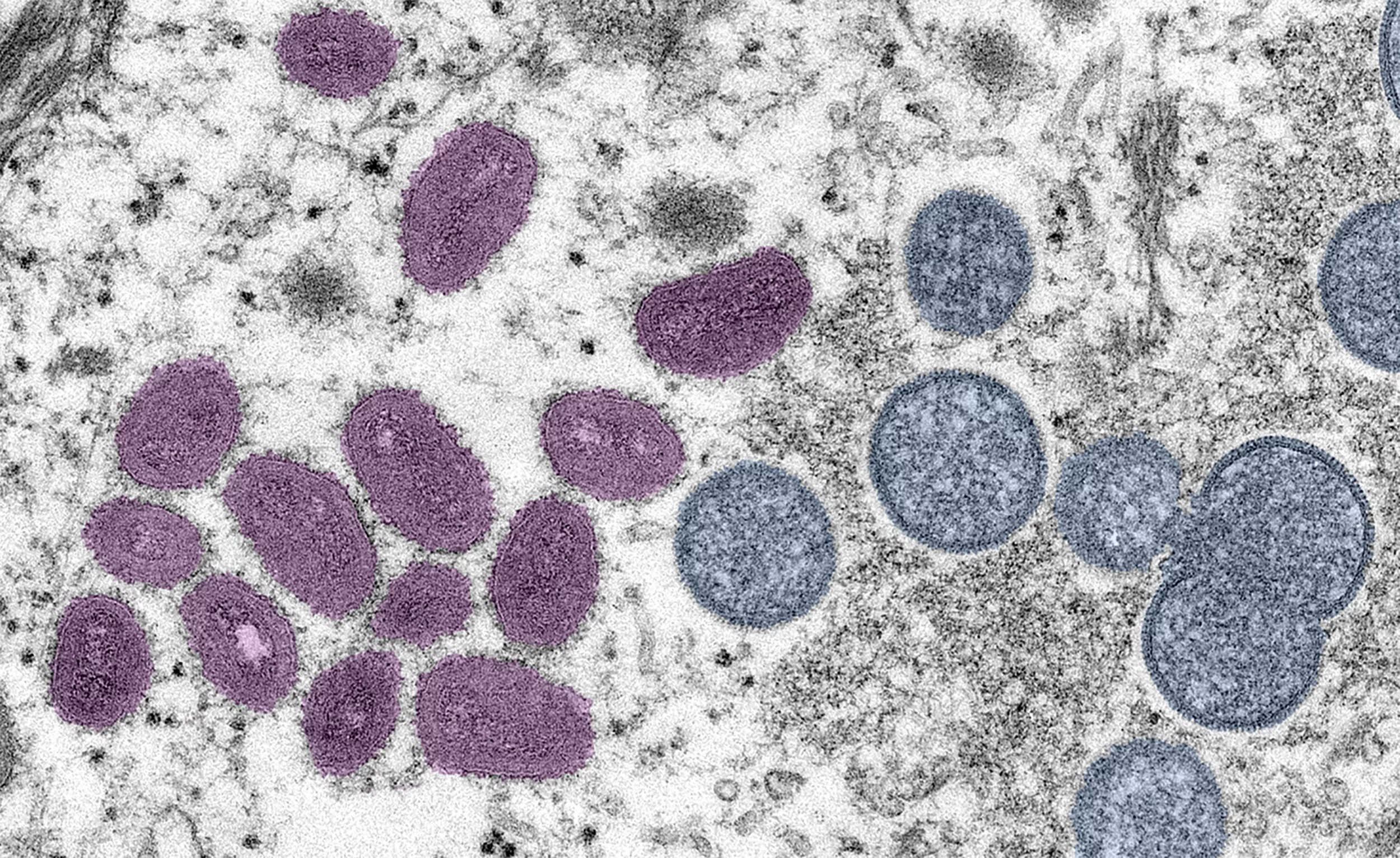 Top Russia Expert Says He's Afraid Gay Sex Can't Explain Monkeypox Spread - Vimarsana News