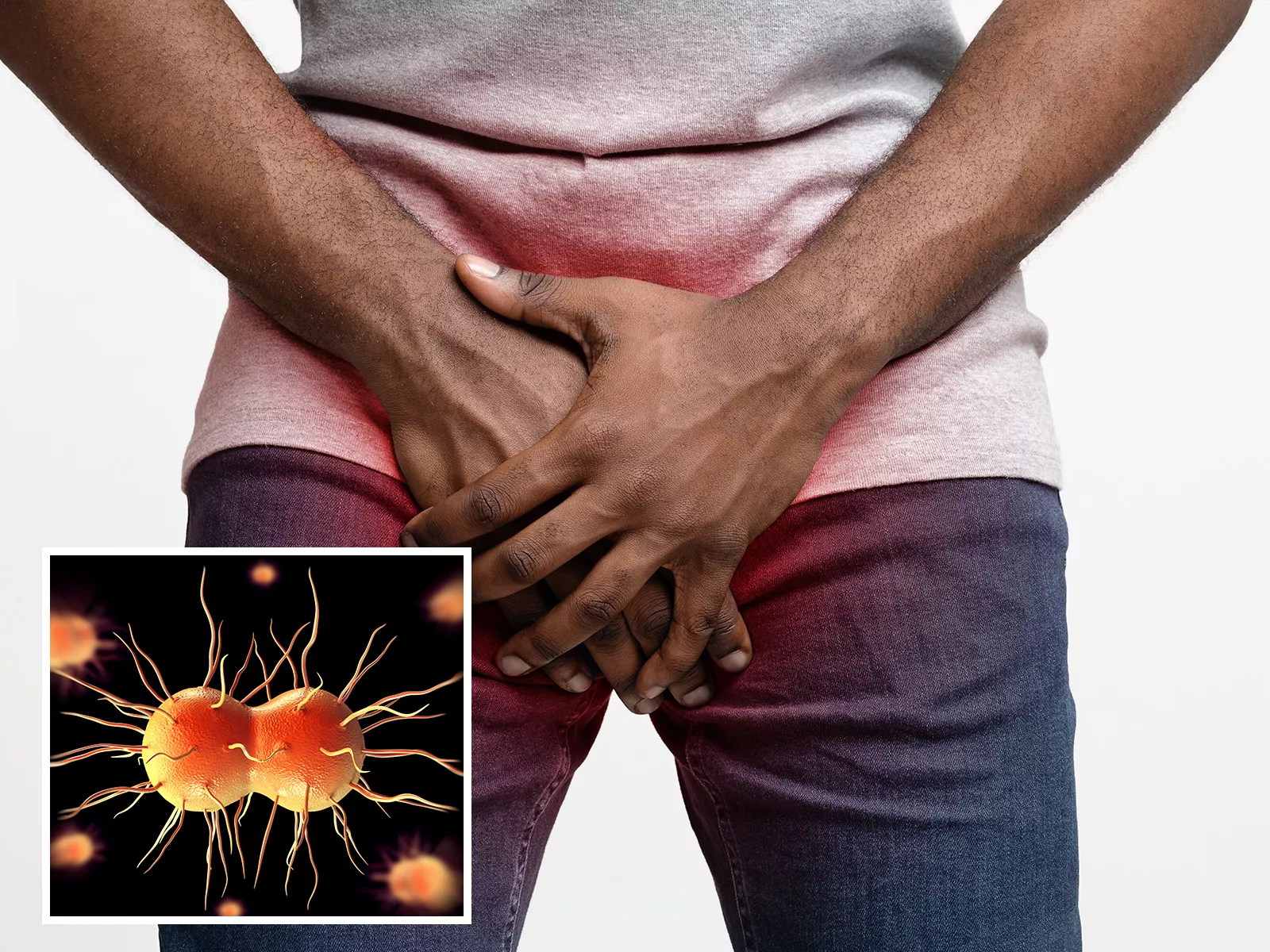 Man Gets Extreme, Super-Gonorrhea after Unprotected Sex with Prostitute