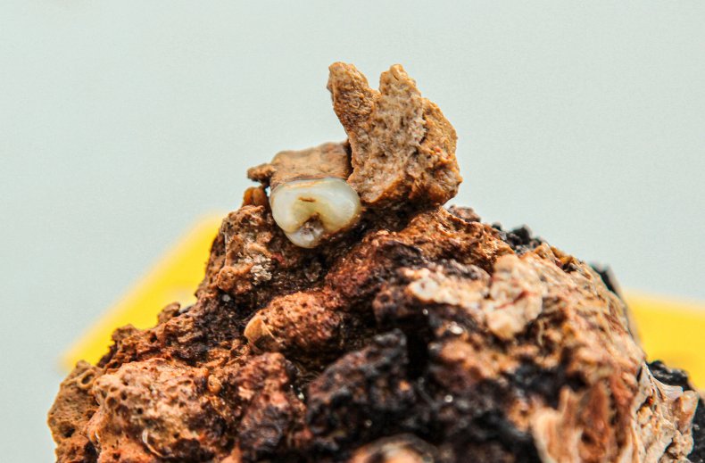 teeth