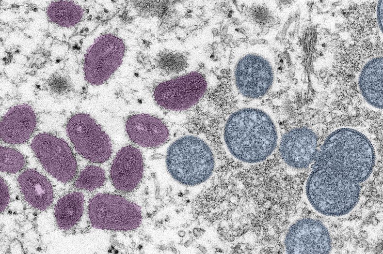 Monkeypox virus particles