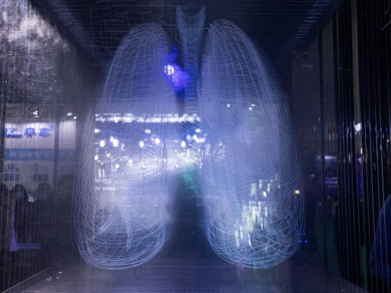 Siemens Lungendisplay