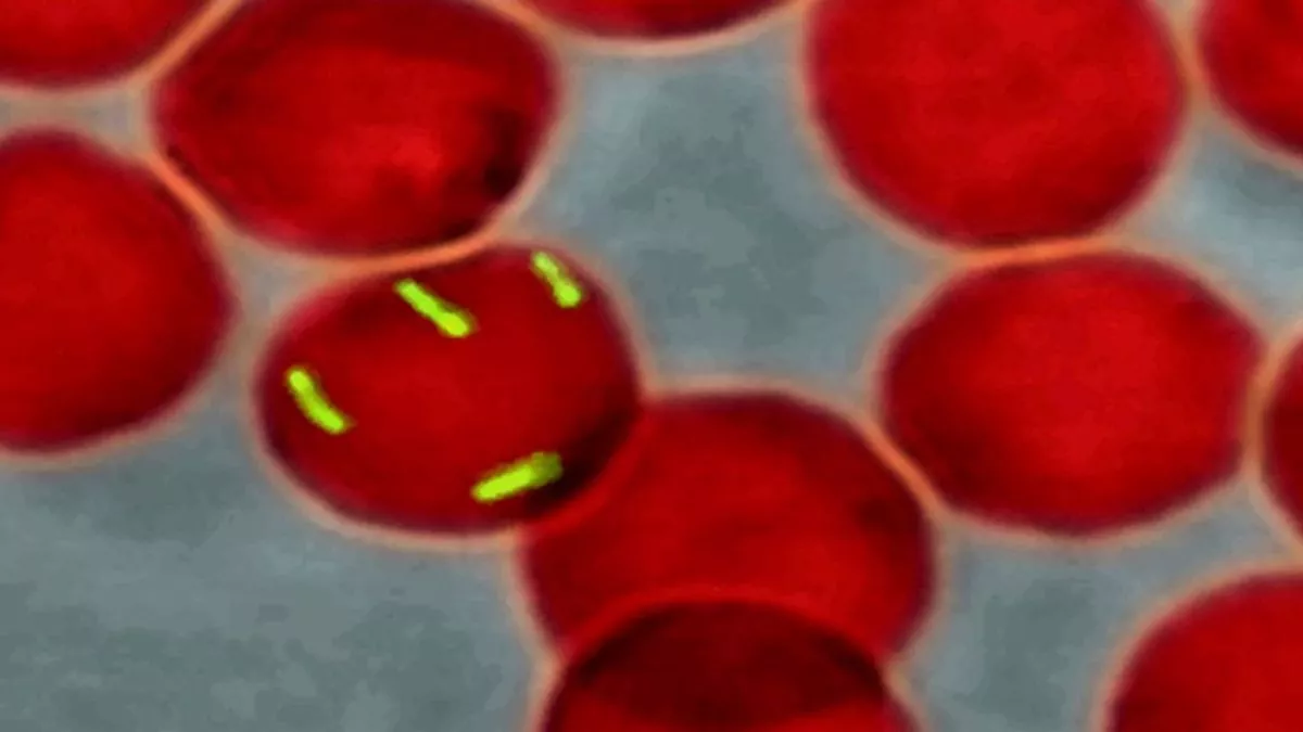 Trench Fever That Affected Tolkien, C.S. Lewis Could Be Prevented: Scientists - Vimarsana News