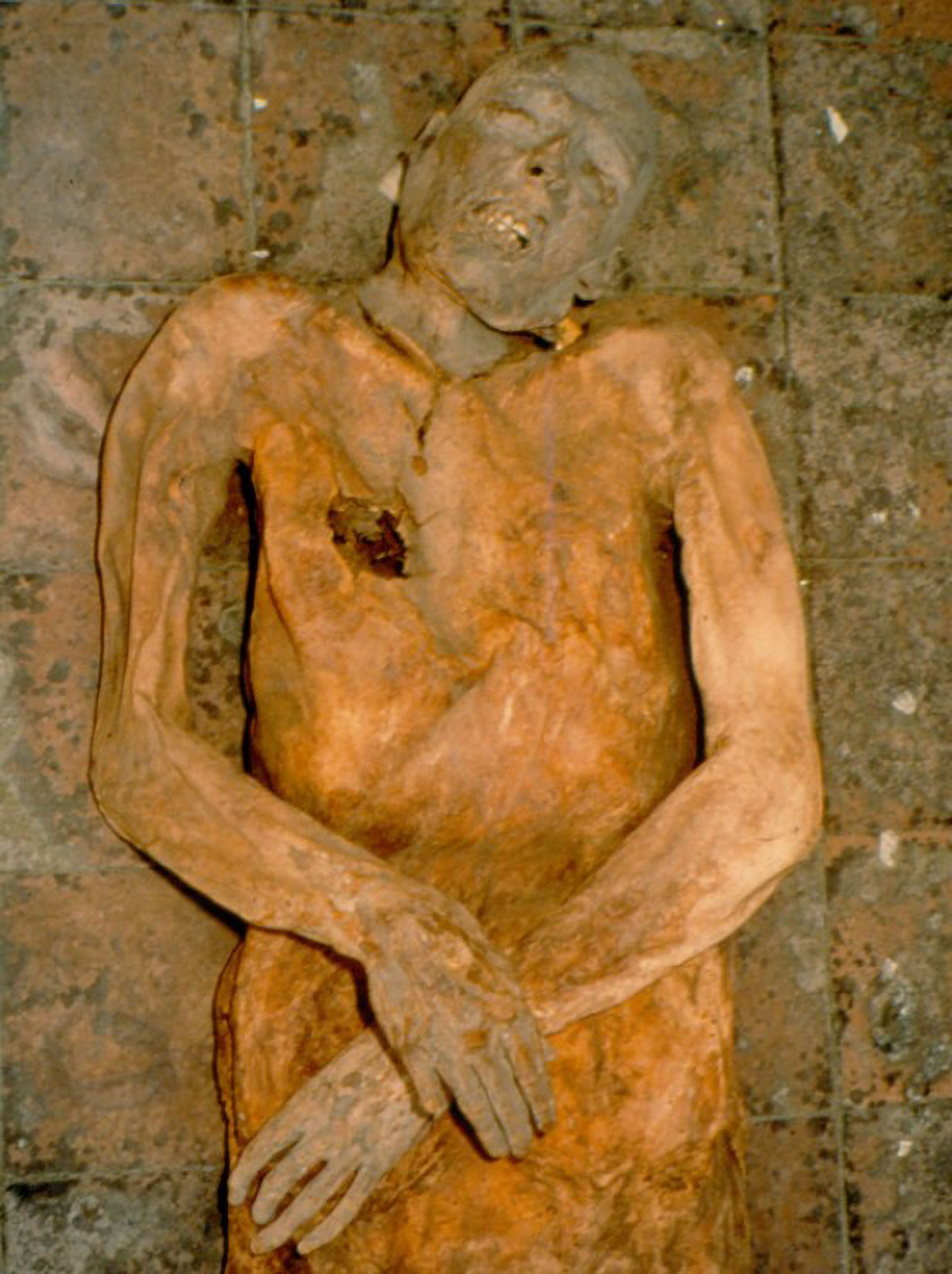 Oldest Known E. Coli Sample Dating Back to 16th Century Extracted From Mummy