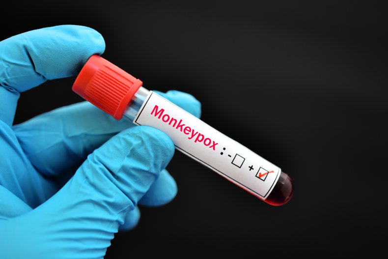 Monkeypox sample