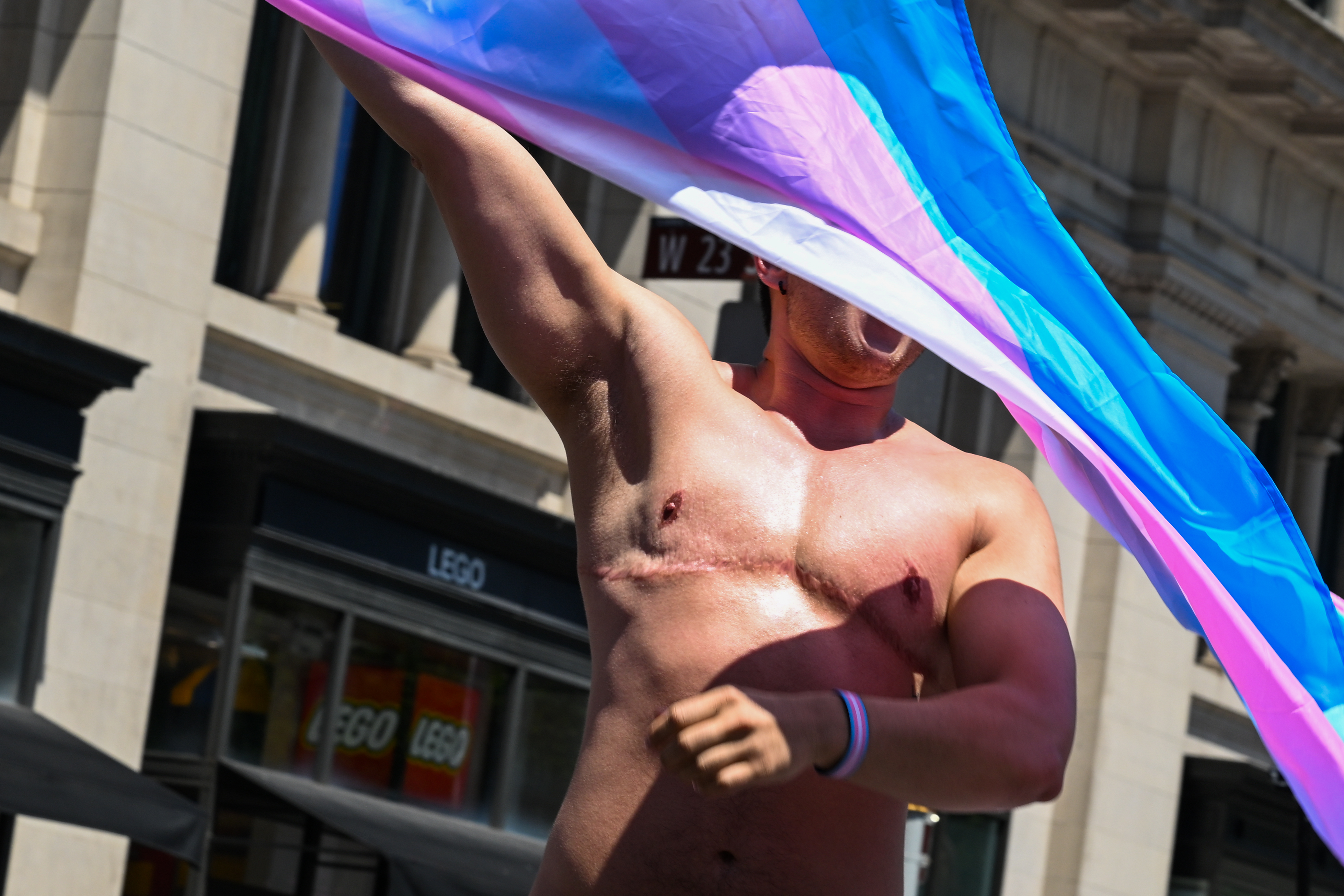 Gender Is Determined at Birth, Say a Growing Number of Americans: Poll