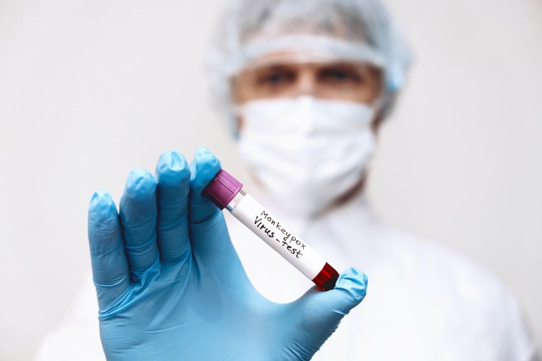 Scientist holding monkeypox sample