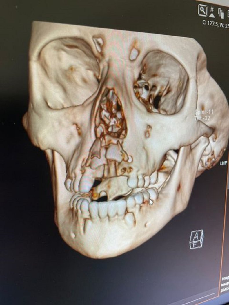 Photo of the child's skull. 