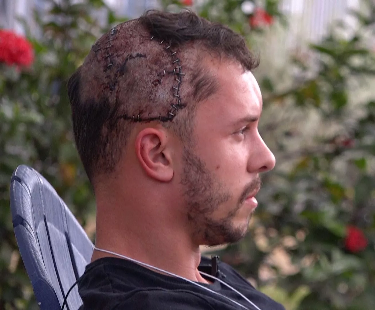 'I Was Attacked By An Alligator—It Had My Head in Its Jaws' - Vimarsana News