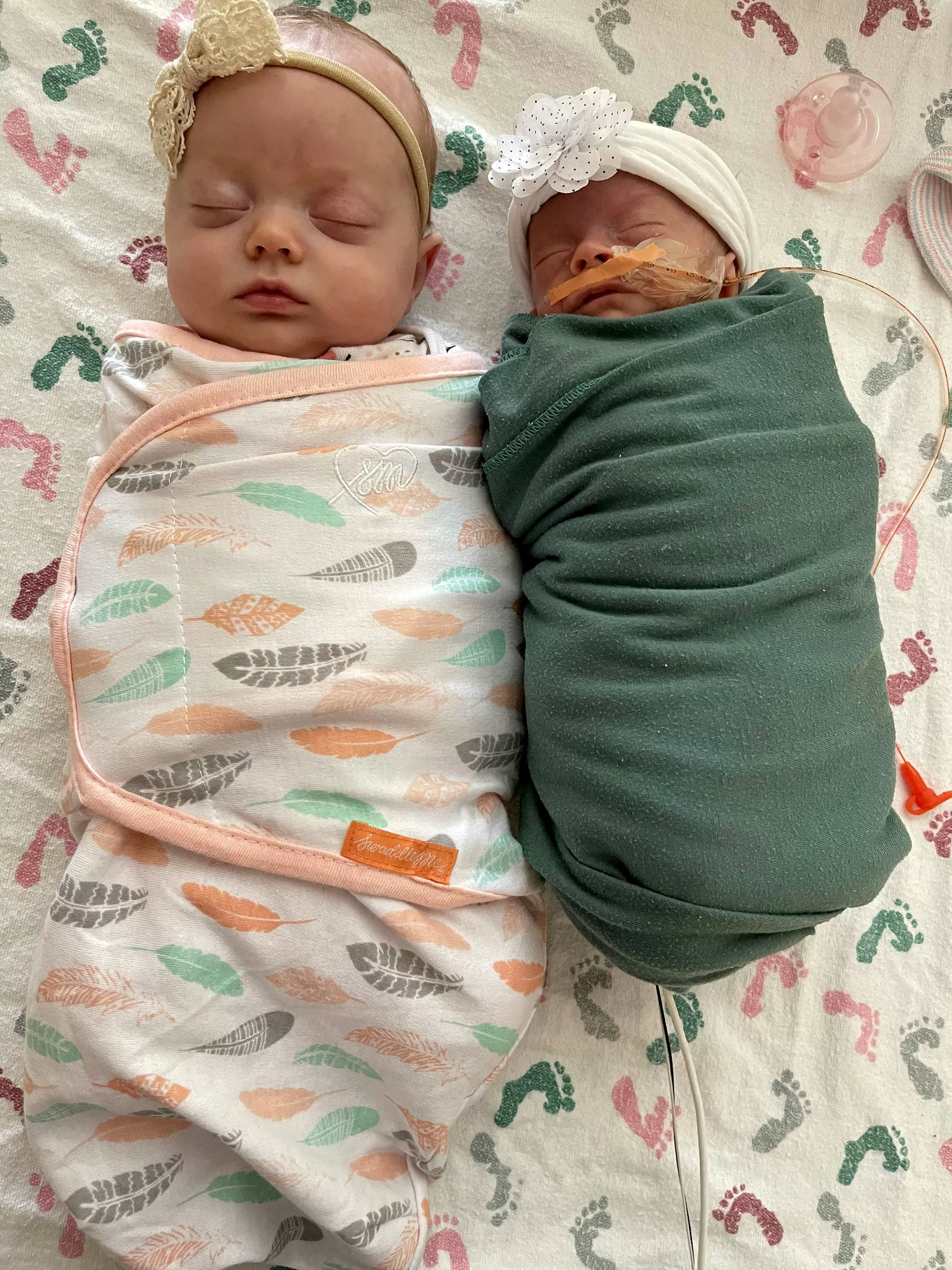 Girl Born Almost 3 Times Smaller Than Her Twin Defies Odds - Vimarsana News