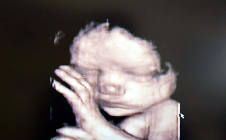 A 3D ultrasound showing a baby inside