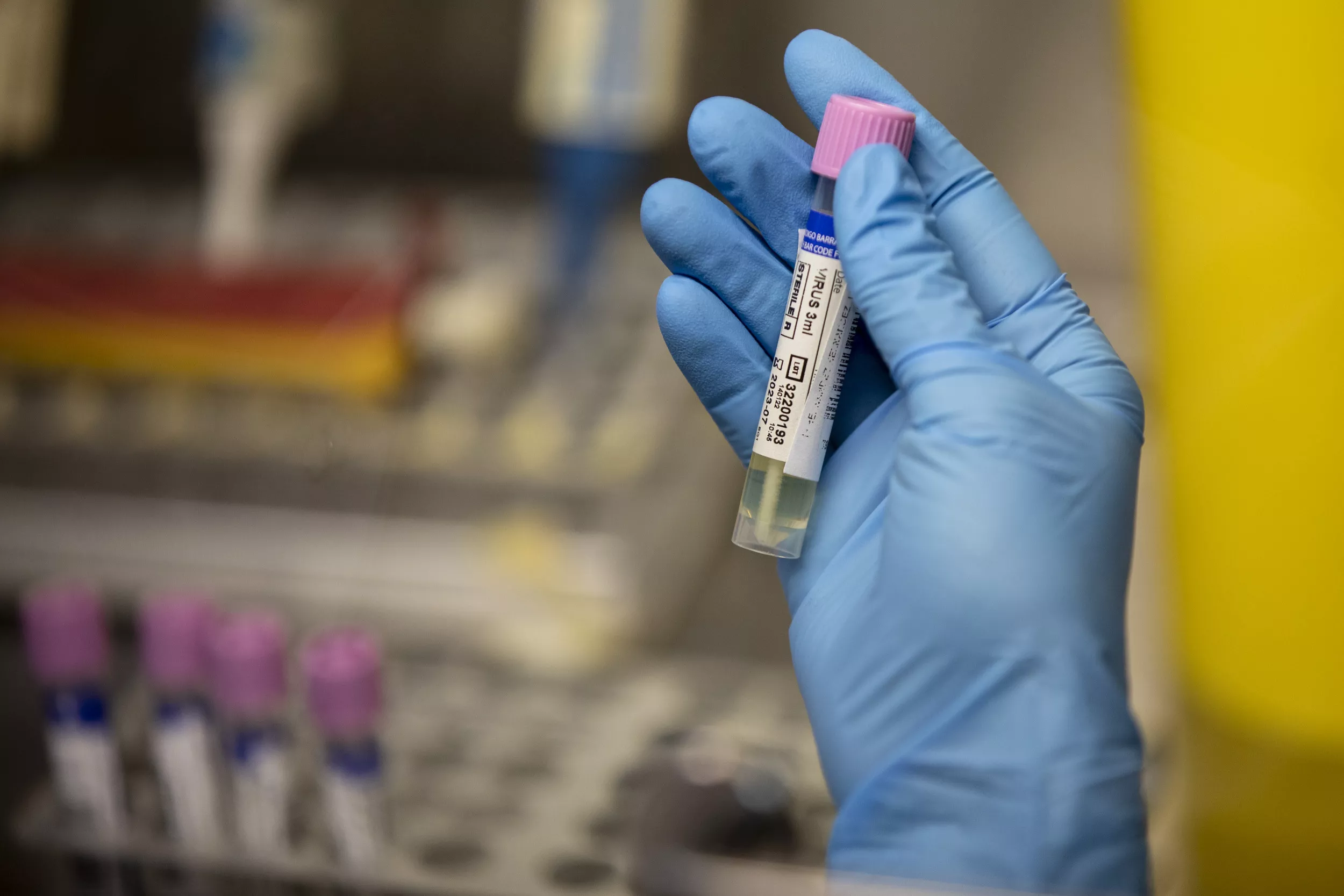 Monkeypox Spread Spurs Major WHO Alert as CDC Confirms Cases in Children - Vimarsana News