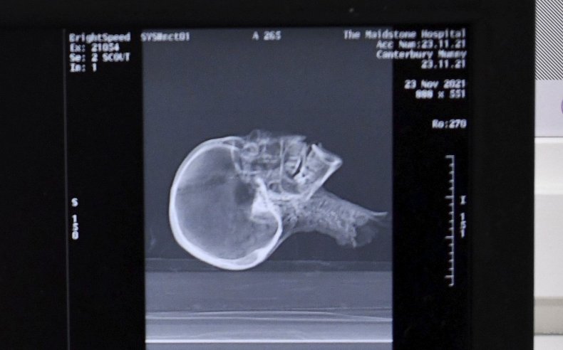 Mummy's head goes into CT scan