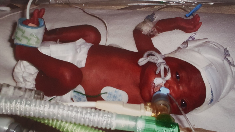 Baby Shaka in The ICU