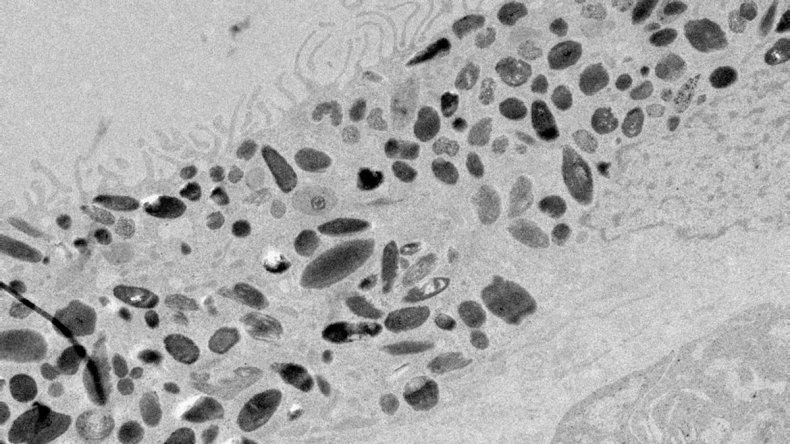 Scan of retinal pigment epithelium cells